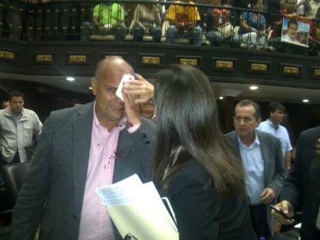 AGRESION-A-WILLIAM-DAVILA