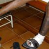 Brasilien: Kostenloser Schnelltest für Lepra